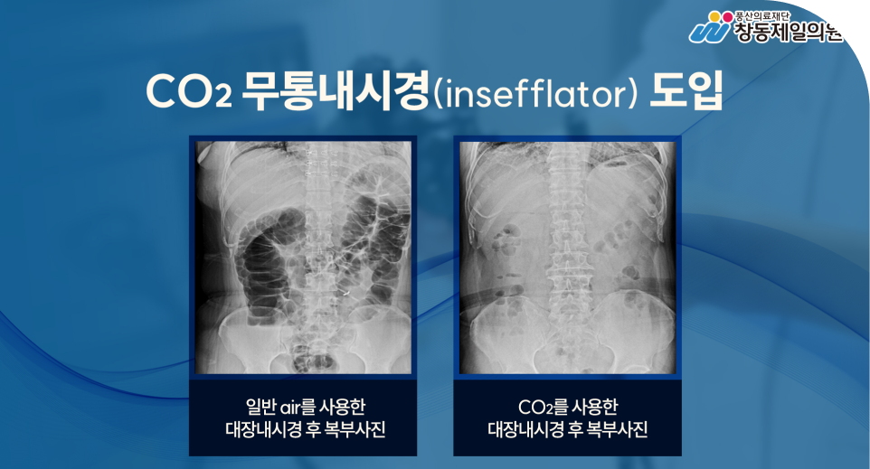 2019년 2월 CO2 insufflator 도입
